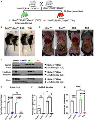 Suppression of the necroptotic cell death pathways improves survival in Smn2B/− mice